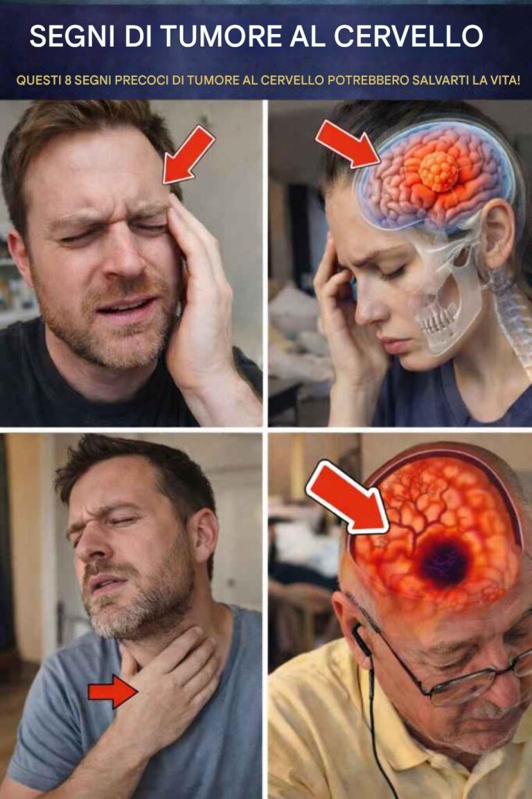 8 segnali precoci di un tumore al cervello da non ignorare mai