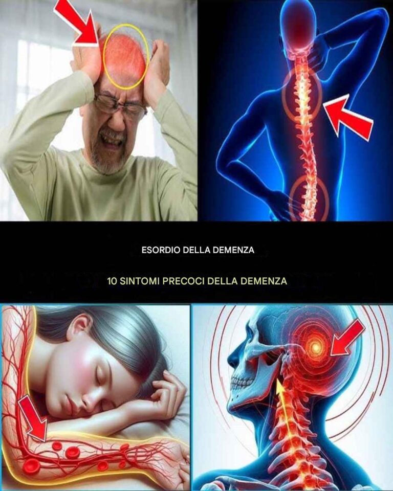 7 SINTOMI PRECOCI DELLA MALATTIA DI ALZHEIMER CHE NON DEVONO MAI ESSERE IGNORATI!