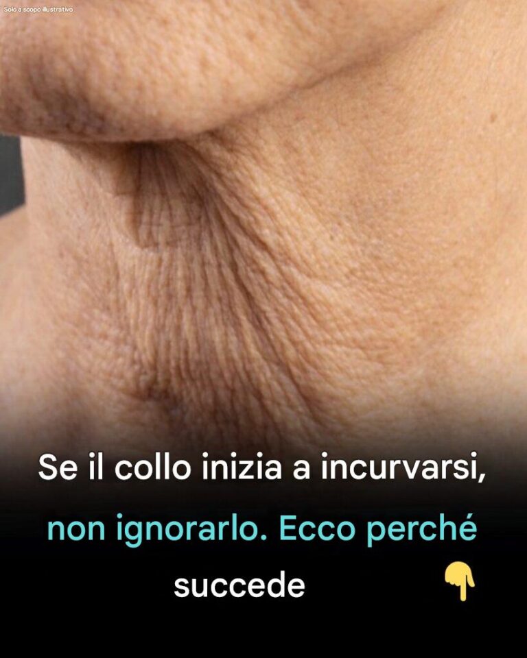 Perché la pelle del collo si rilassa con l’età e cosa si può fare al riguardo