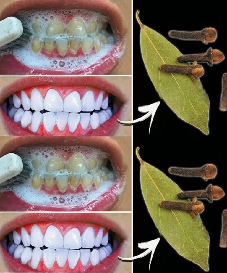 Rimuovi il tartaro e sbianca i denti in modo naturale